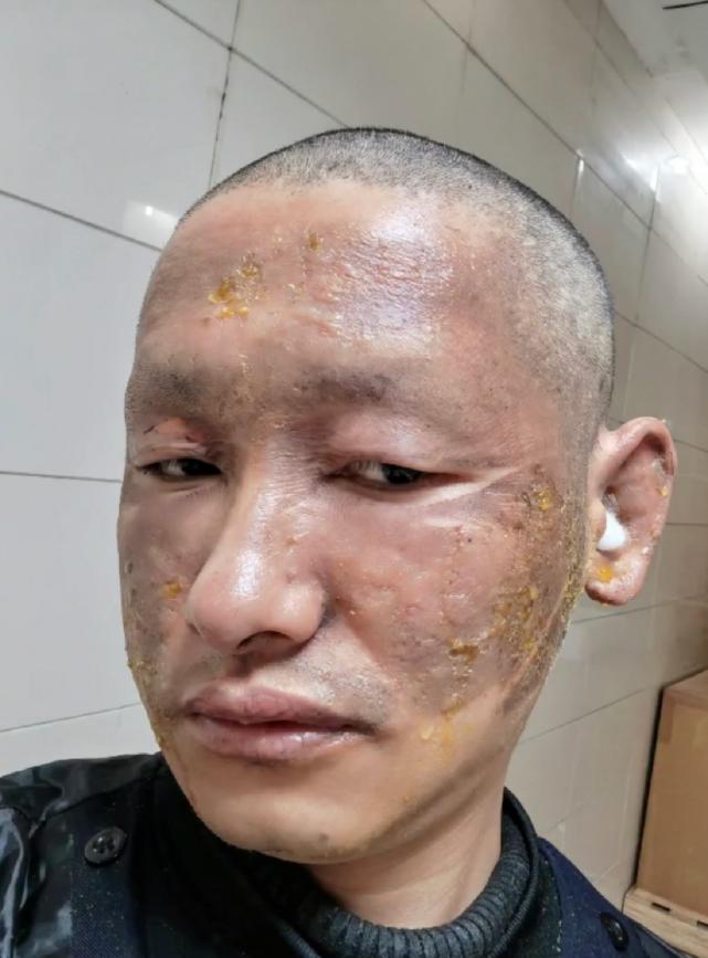 探索星光的奧秘，明星天臉重塑魅力的奇跡之旅