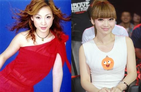 明星隆胸背后的審美趨勢與個人立場探討