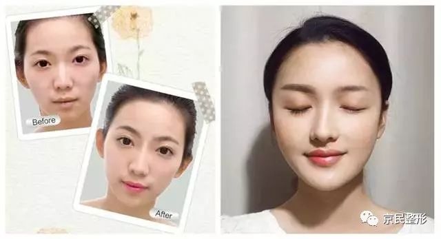 最新眉部美容技術(shù)，塑造完美眉型，瞬間驚艷全場(chǎng)的美顏秘訣 ???