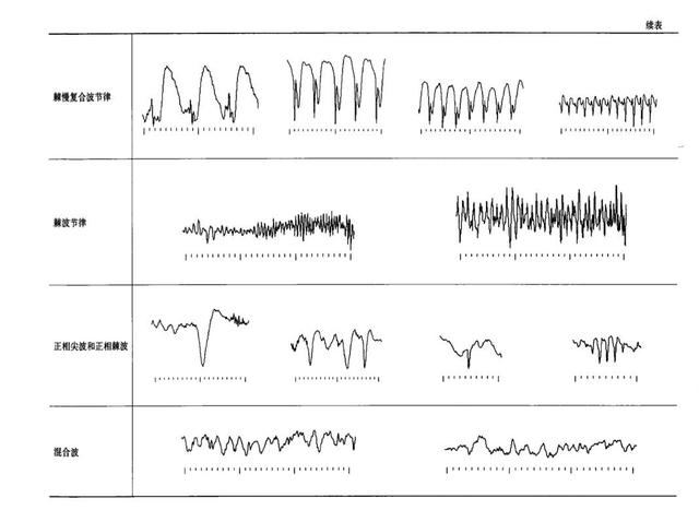 視頻腦電圖之旅，愛與陪伴的溫馨故事探尋價格揭秘