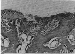 最新沷尼松研究與應(yīng)用進(jìn)展的探討